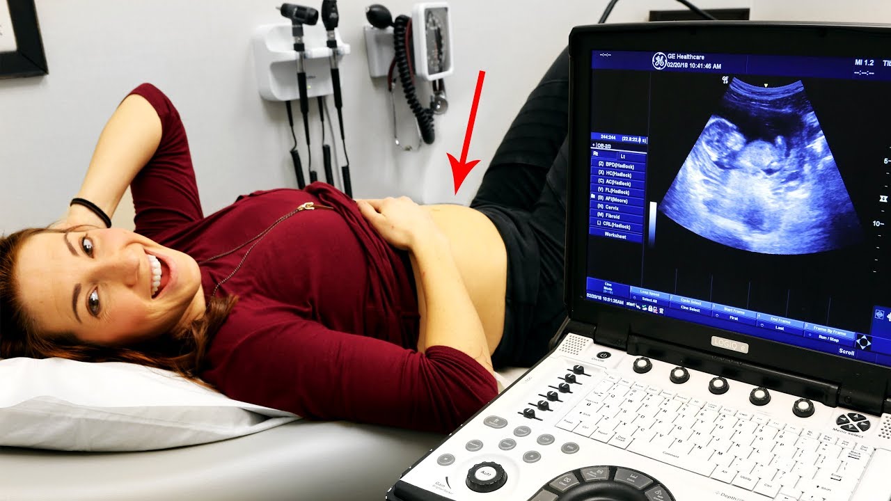 Doctor Knows the Baby's Gender! - 14 Week Pregnancy Ultrasound