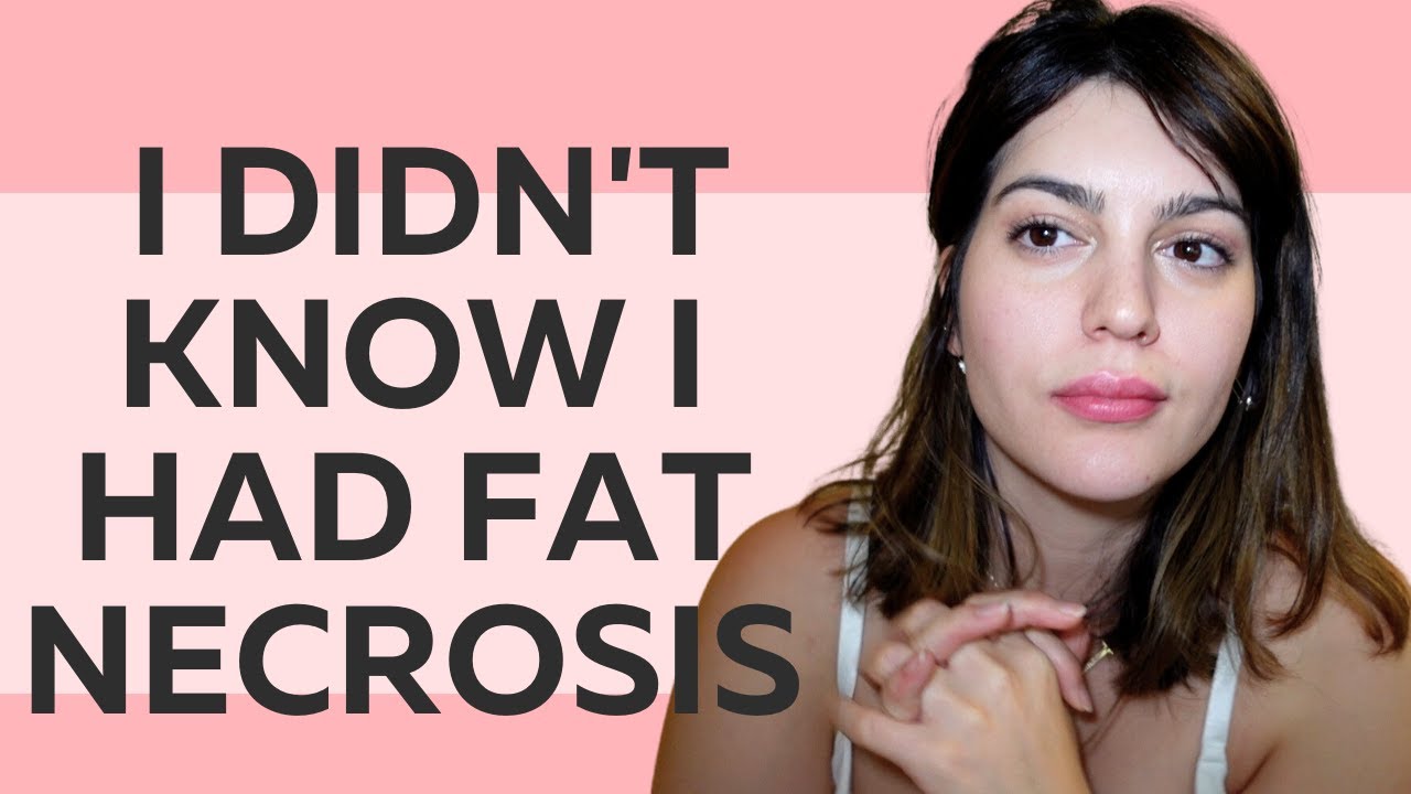 ALL ABOUT FAT NECROSIS AFTER FAT TRANSFER TO BREASTS