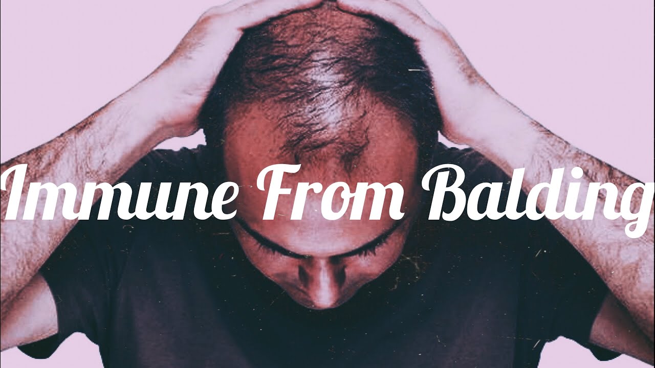 Become Immune From Balding {FᎾᎡᏟᎬᎠ & ᏢᎾᏔᎬᎡFᏌᏞ} (REQUESTED) ~ Subliminal
