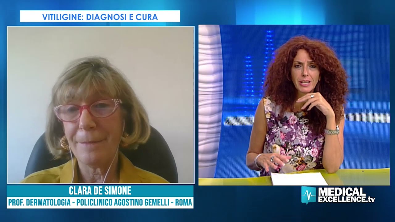 Malattie della pelle: vitiligine, diagnosi e cura