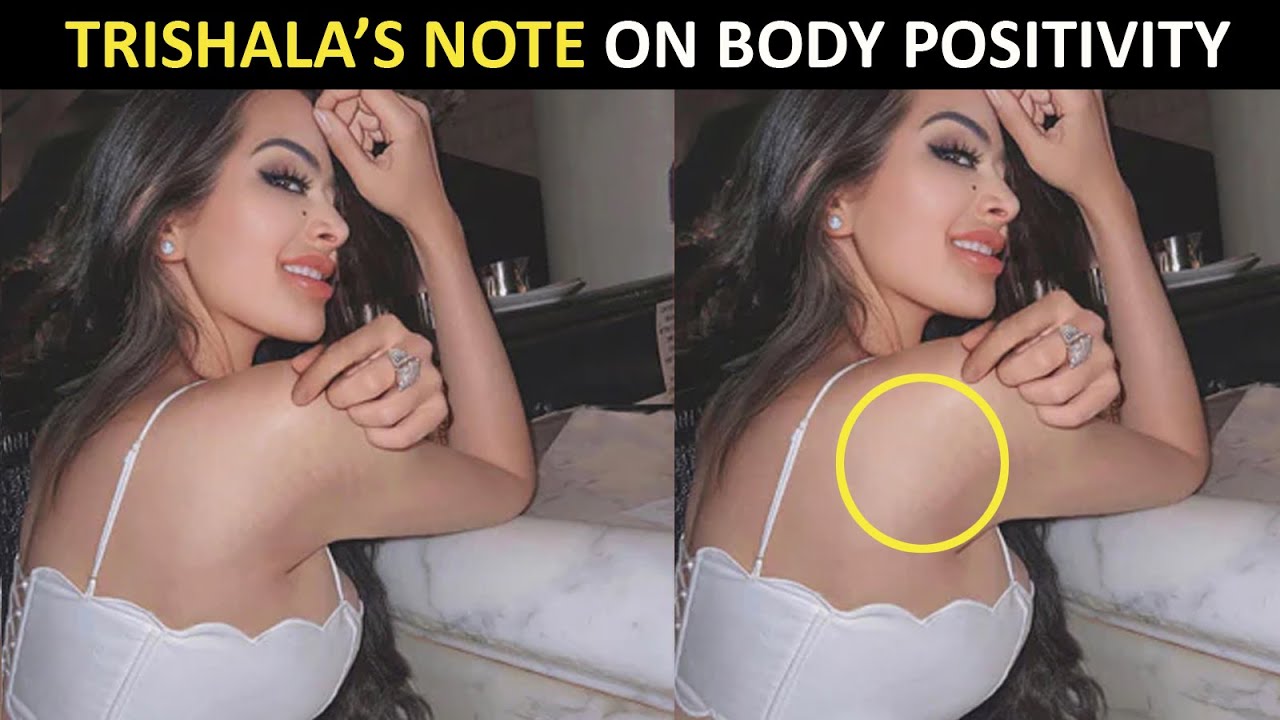 Sanjay Dutt&rsquo;s daughter Trishala Dutt shows her 'battle wounds'