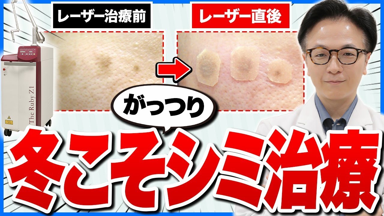 冬こそシミ治療！その理由を医師がわかりやすく解説
