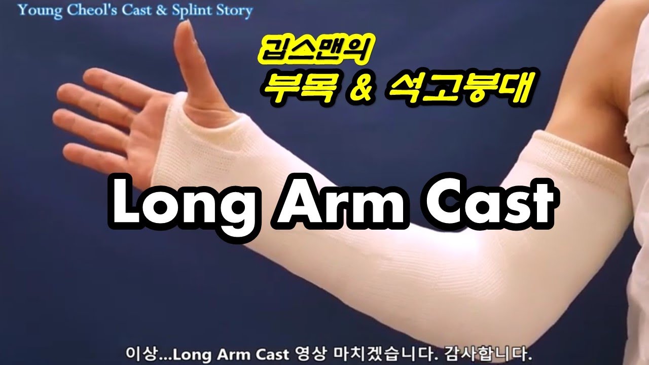 Long Arm Cast