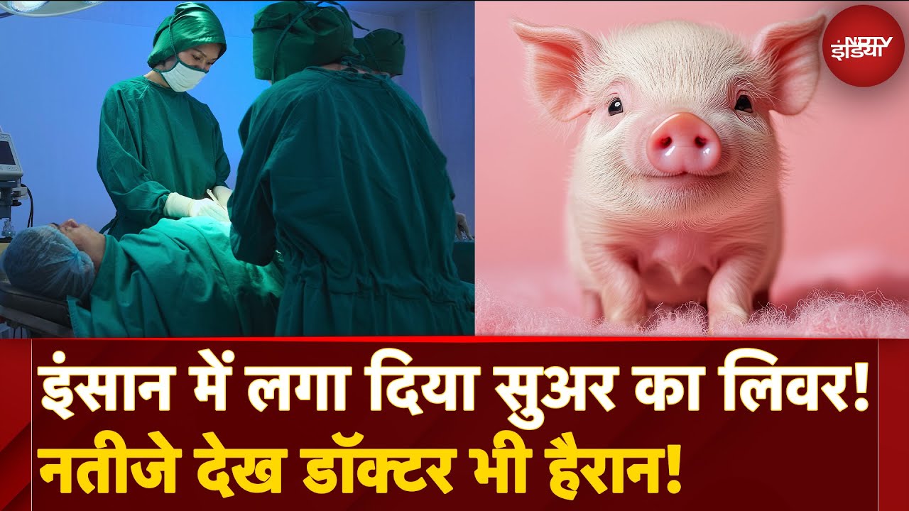Brain Dead Man में Miniature Pig का Liver Transplant कर दिया! Chinese Doctors का अनोखा कारनामा