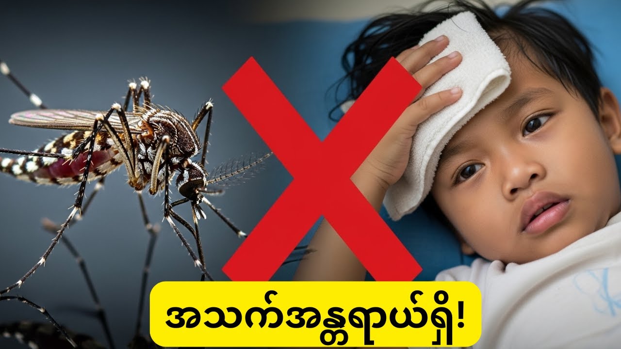 သွေးလွန်တုပ်ကွေး (Dengue Fever): အရေးကြီးဆုံး အသက်ကယ်လက္ခဏာ (၅) ချက်