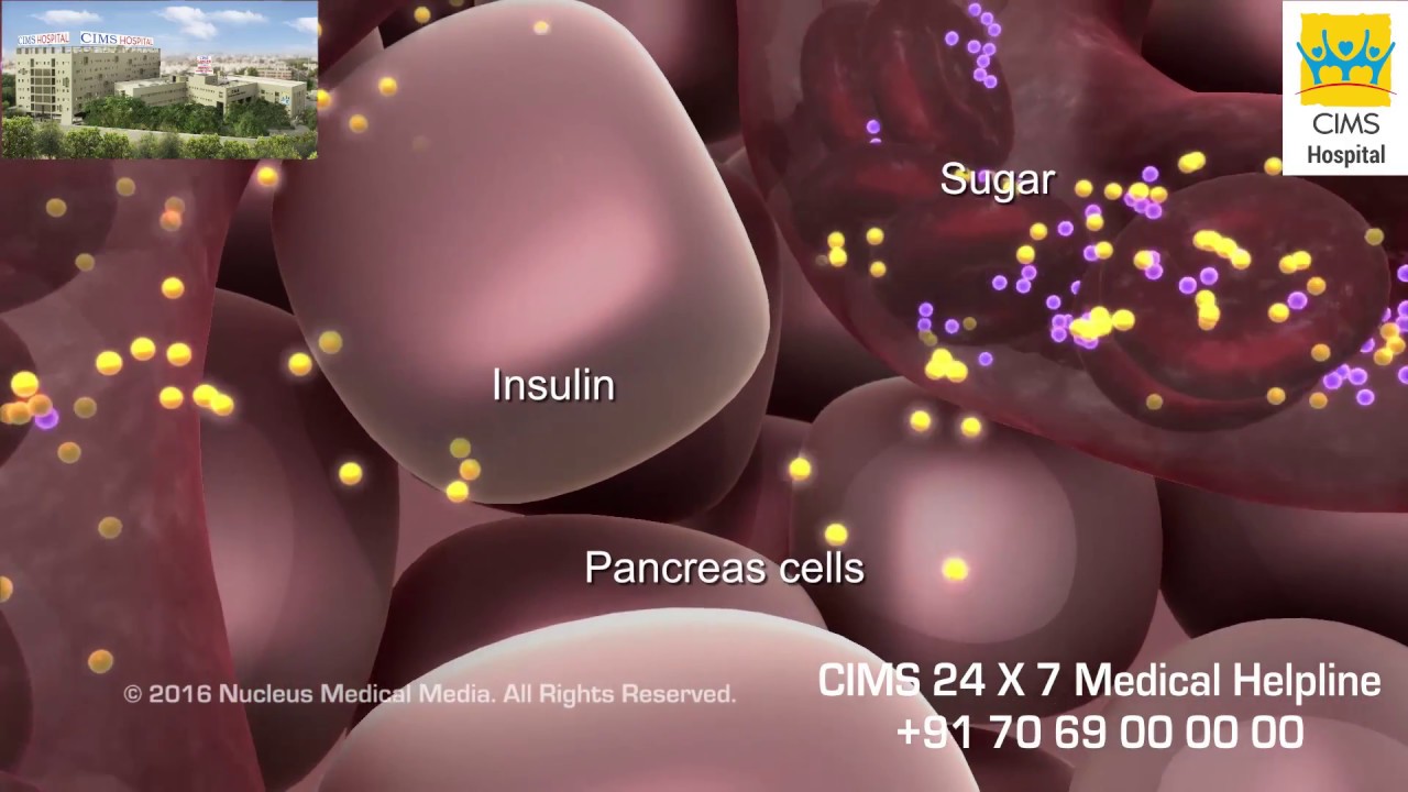 Type 1 Diabetes - CIMS Hospital