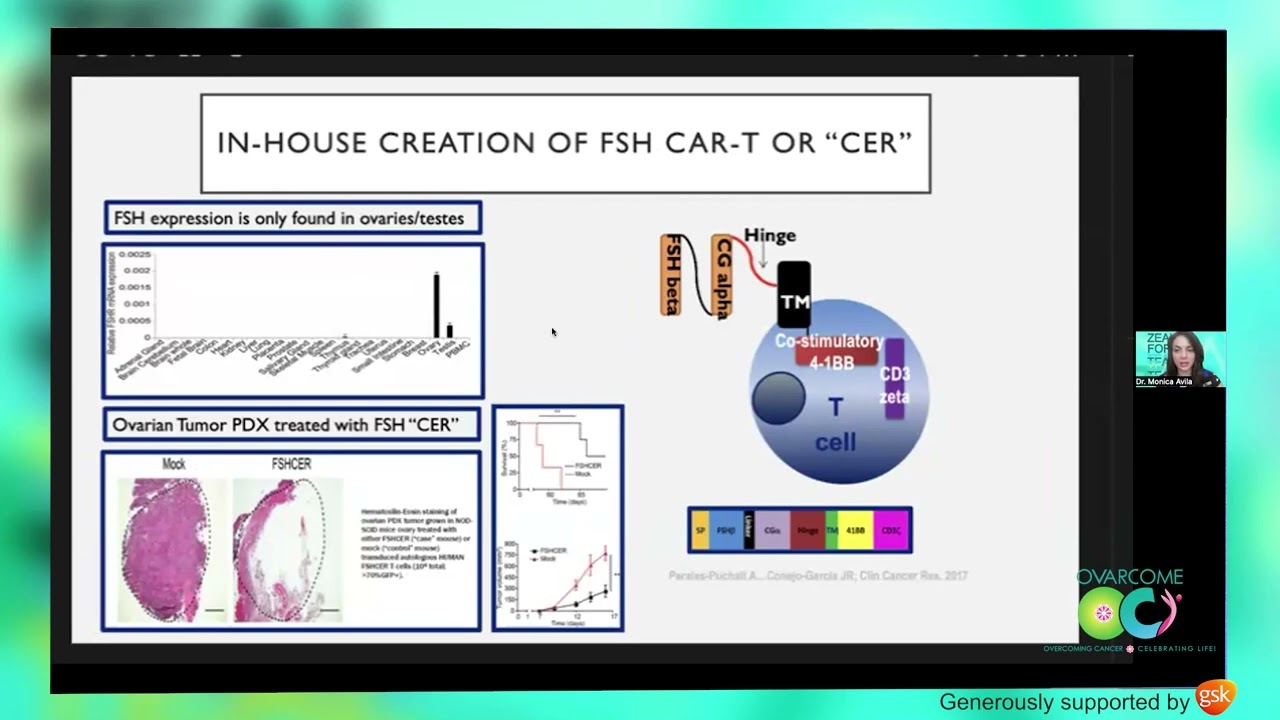Groundbreaking CAR-T Cell Therapy in Ovarian Cancer