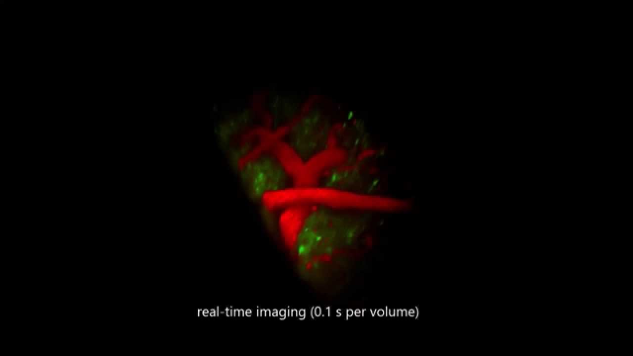 SCAPE real-time 3D microscopy - Intact brain