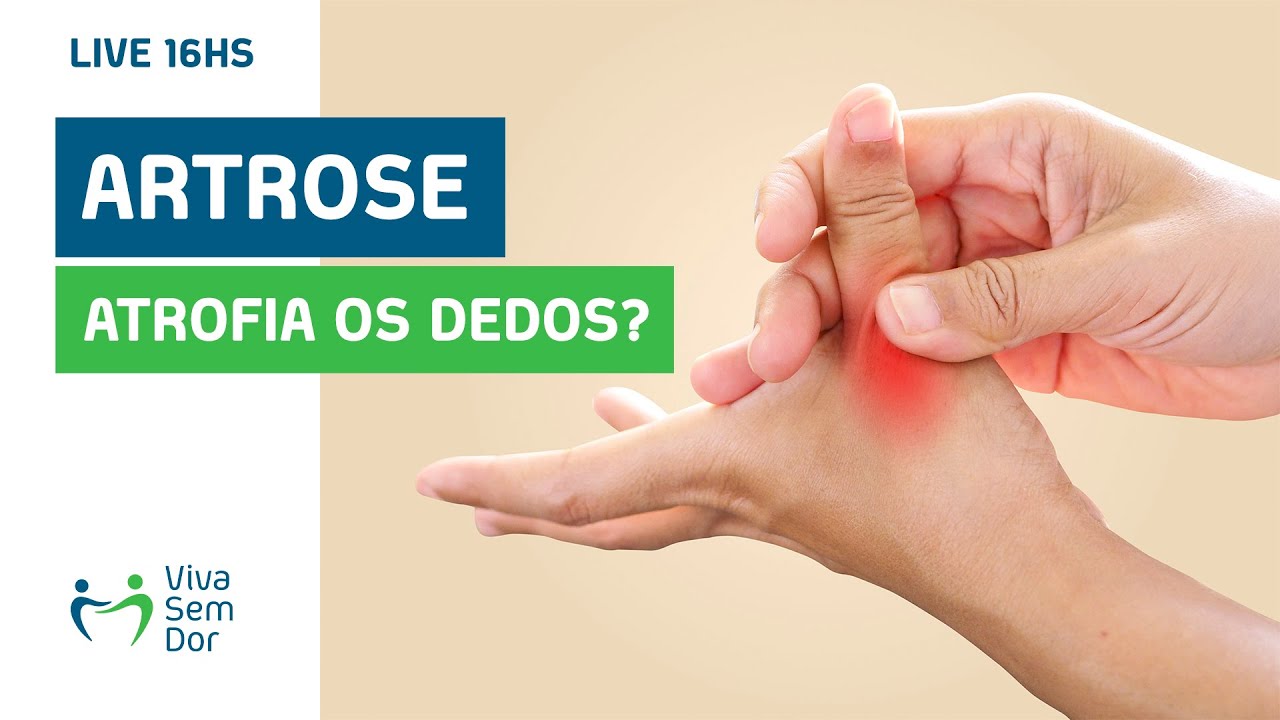 Artrose nas mãos pode causar atrofia dos músculos dos dedos?