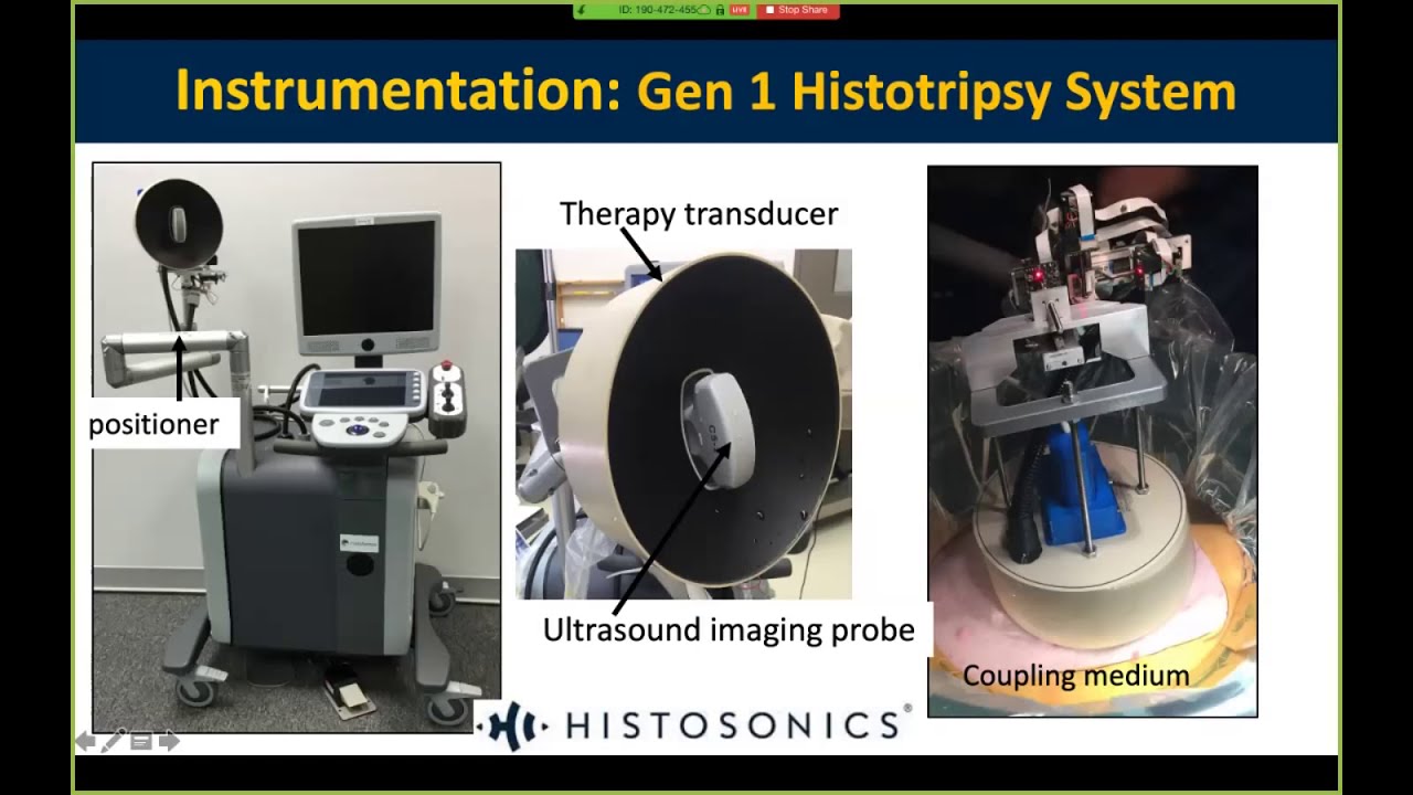 Webinar: Zhen Xu, PhD - Histotripsy for Treatment of Cancer and Neurological Diseases