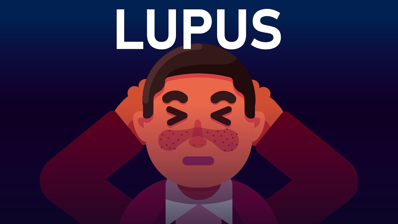The Disease That Has A Thousand Symptoms