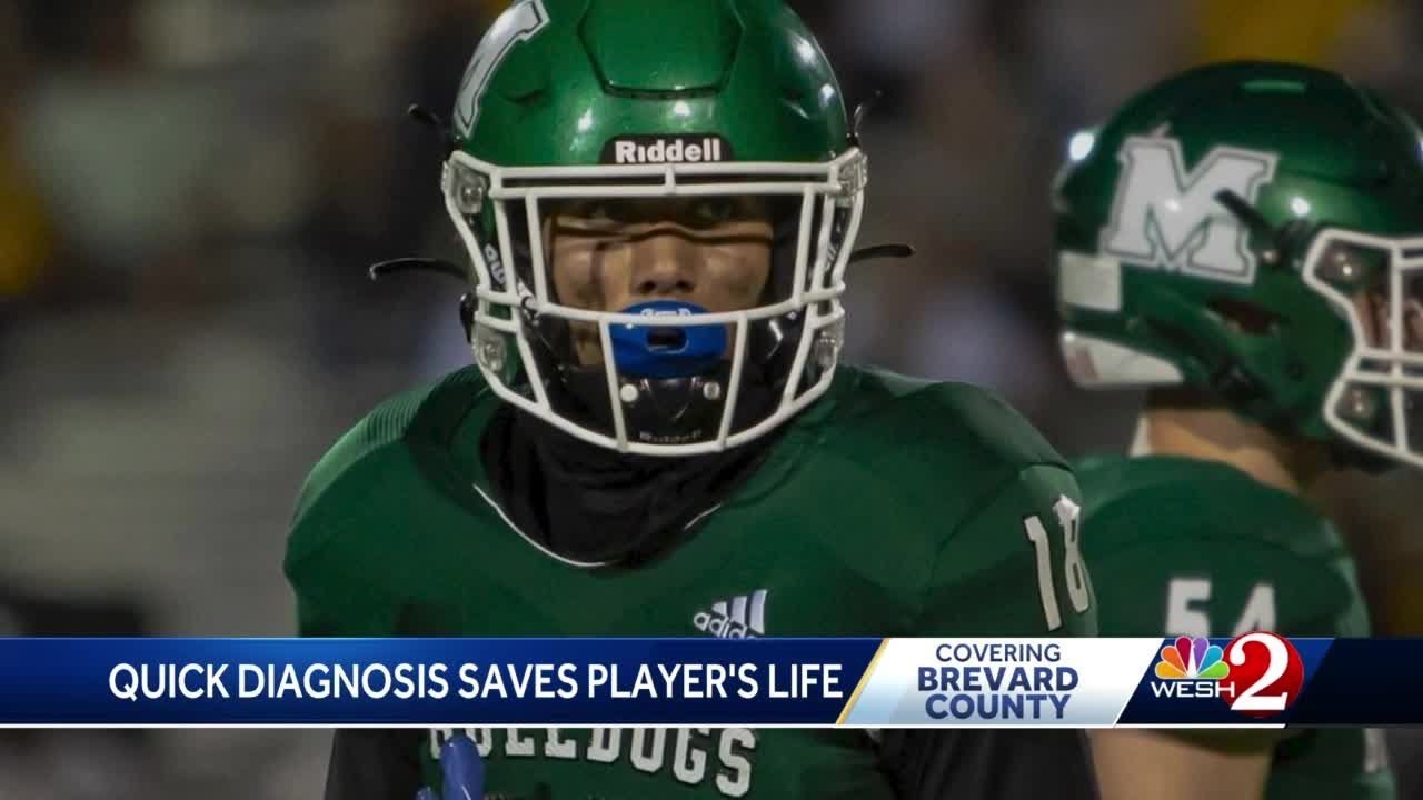 Athletic trainer's quick diagnosis of injury saves Brevard County football player's life