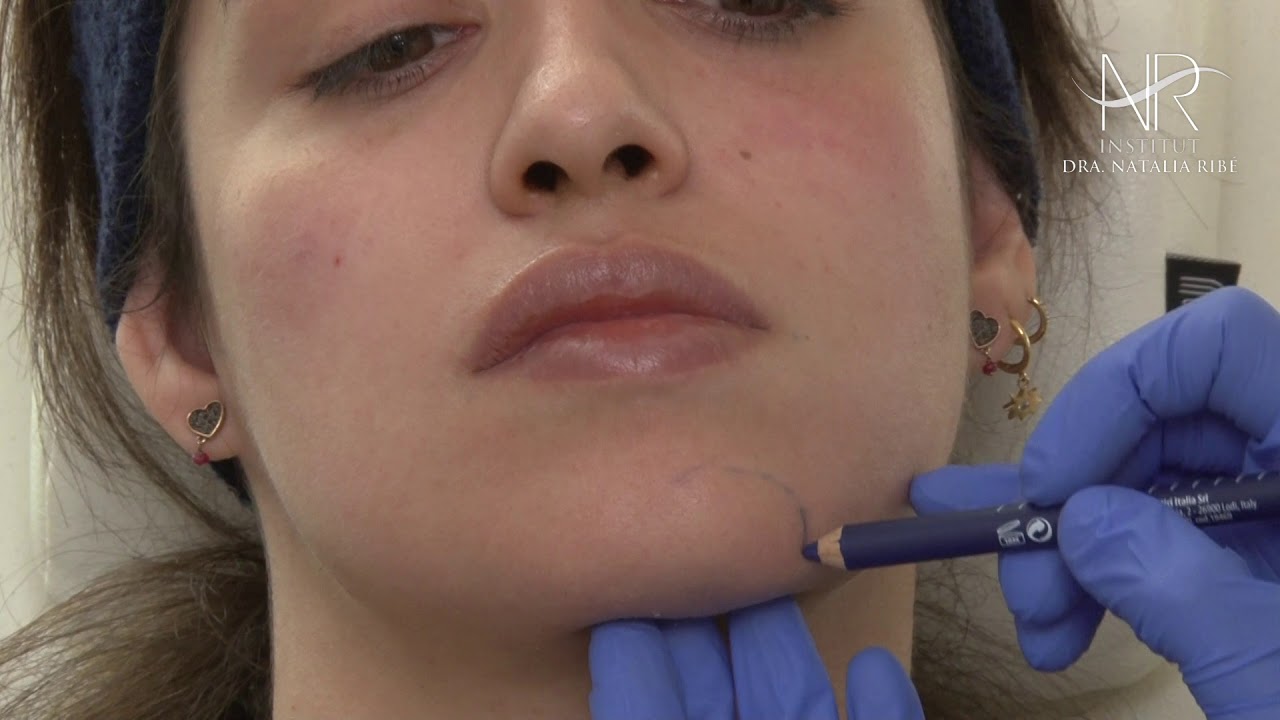Tratamiento de hidratación y reestructuración del tejido del rostro - Institut Dra. Natalia Ribé
