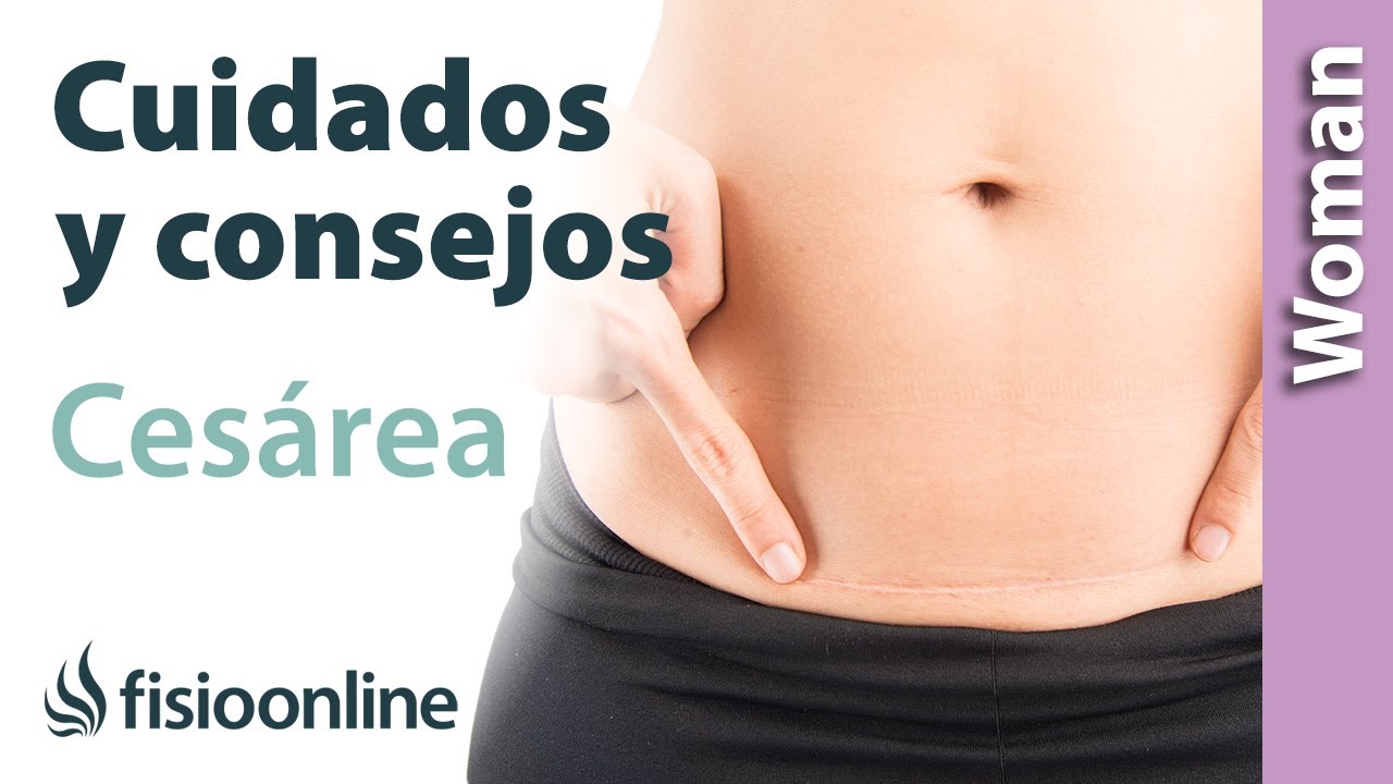 ✅CUIDADOS y CONSEJOS para el POST OPERATORIO de una CES&Aacute;REA🤰🏻