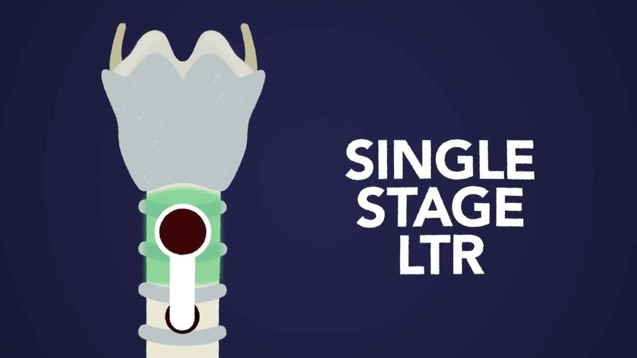 Laryngotracheal Reconstruction (LTR): What You Need to Know