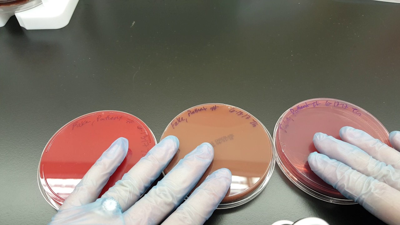 Microbiology: How to streak a Primary Set-up with a Swab Part 1