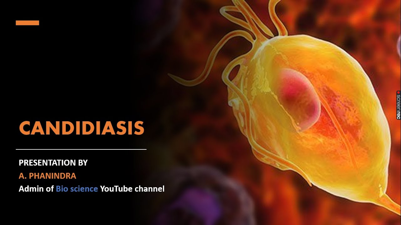 Candidiasis | Vaginal candidiasis, Cutaneous candidiasis, Oral candidiasis | Causes and Symptoms