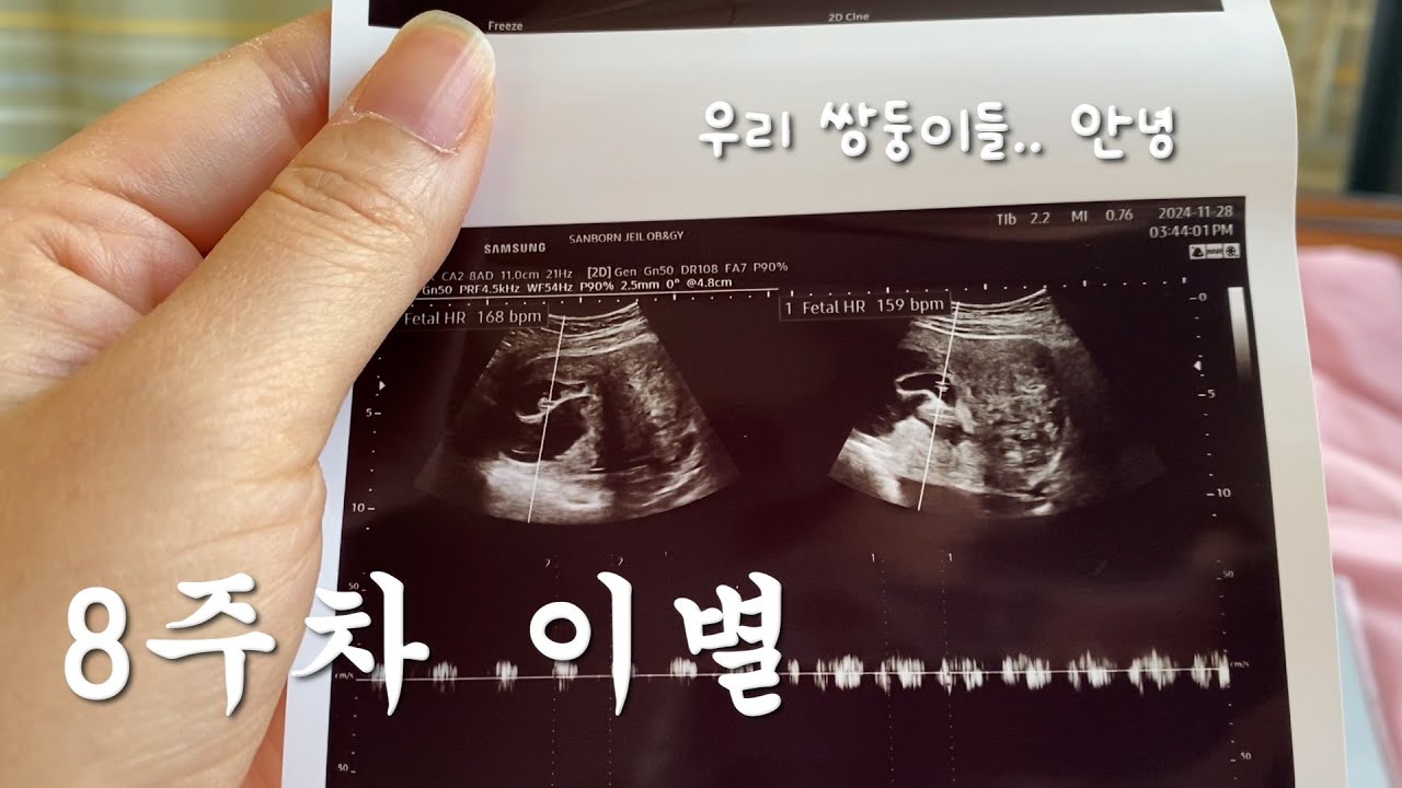 [난임 vlog] 30대 유방암환자의 시험관 과정/ 임신 6주6일차 피고임 입원/ 절박유산 진단/ 8주차 자연배출이 되기까지