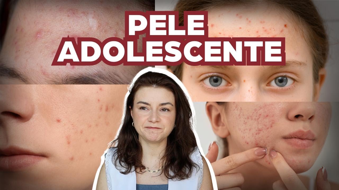 3 passos de como fazer skincare na adolescência