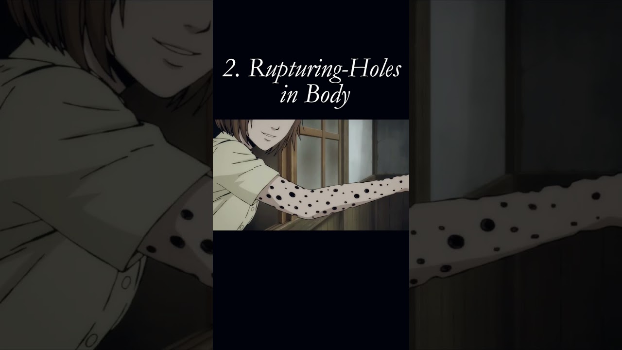 most cuelest diseases shown in Junji Ito Collection Anime. #anime #horror #junjiitocollection