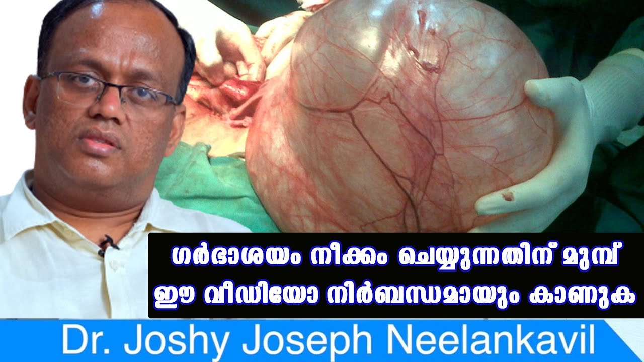 ഗർഭാശയം നീക്കം ചെയ്യുന്നതിന് മുമ്പ് ഈ വീഡിയോ നിർബന്ധമായും കാണുക /Baiju's Vlogs
