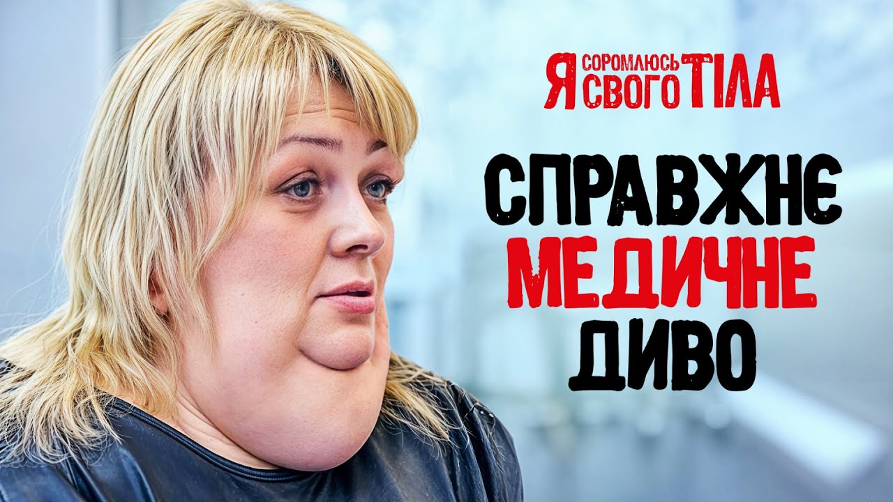 Впервые стал на ровные ноги – Я соромлюсь свого тіла | ЛЕЧЕНИЕ | ДОКАЗАТЕЛЬНАЯ МЕДИЦИНА | БОЛЕЗНИ