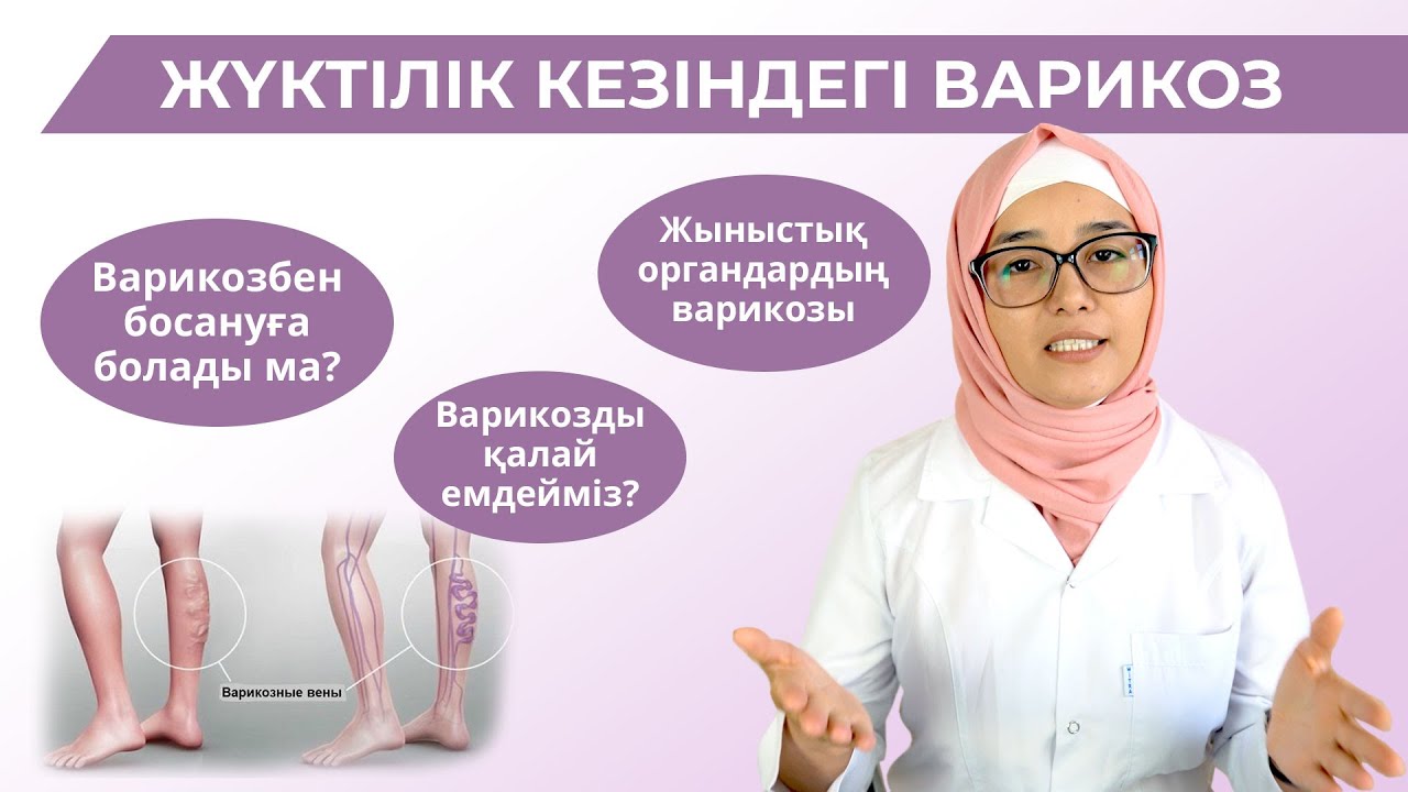 Жүктілік кезіндегі варикоз/Варикоз болса табиғи жолмен босануға болады ма?