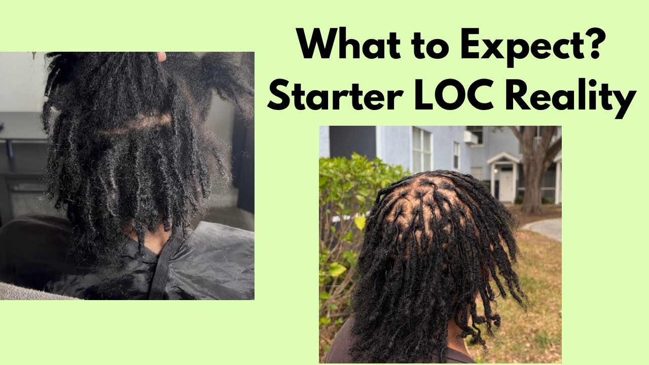 Starter Locs: What No One Tells You 👀