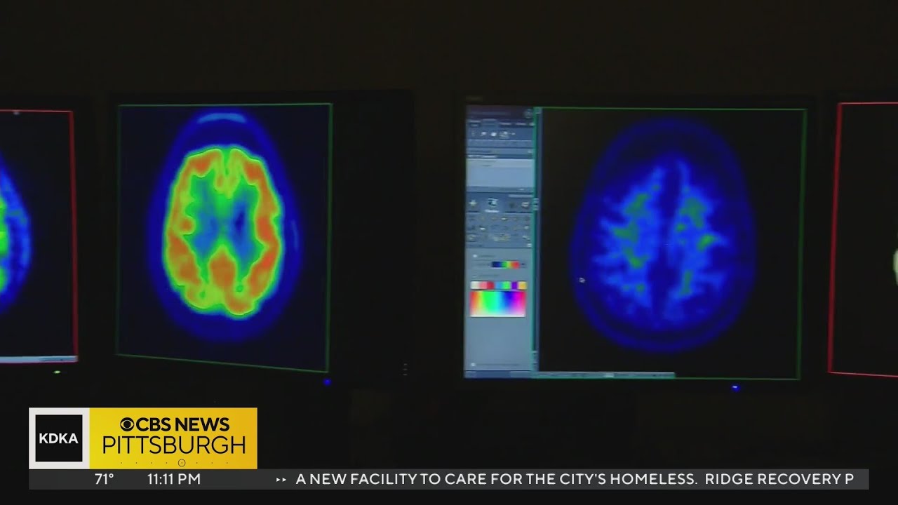 Allegheny Health Network to open new neurological facility