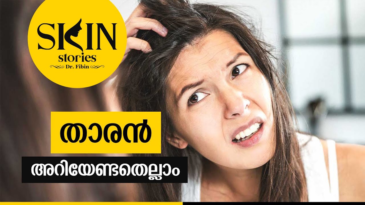 താരൻ - അറിയേണ്ടതെല്ലാം | Dandruff & Seborrheic Dermatitis | Dr. Fibin | Skin Stories #10