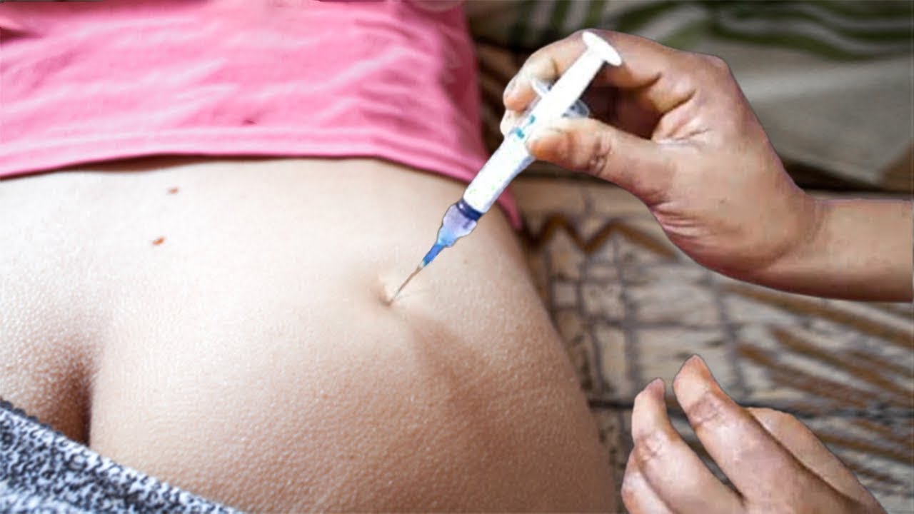Title: Hip IM Injection Technique | Safe Buttocks Injection Step by Step | Nurse Training Guide