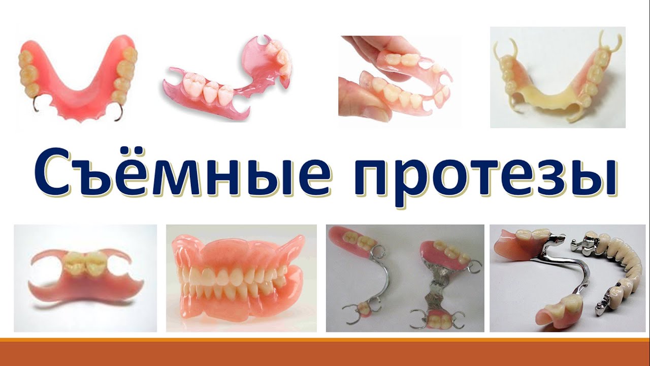 Секреты Стоматологии - Глава 5. Съёмные протезы