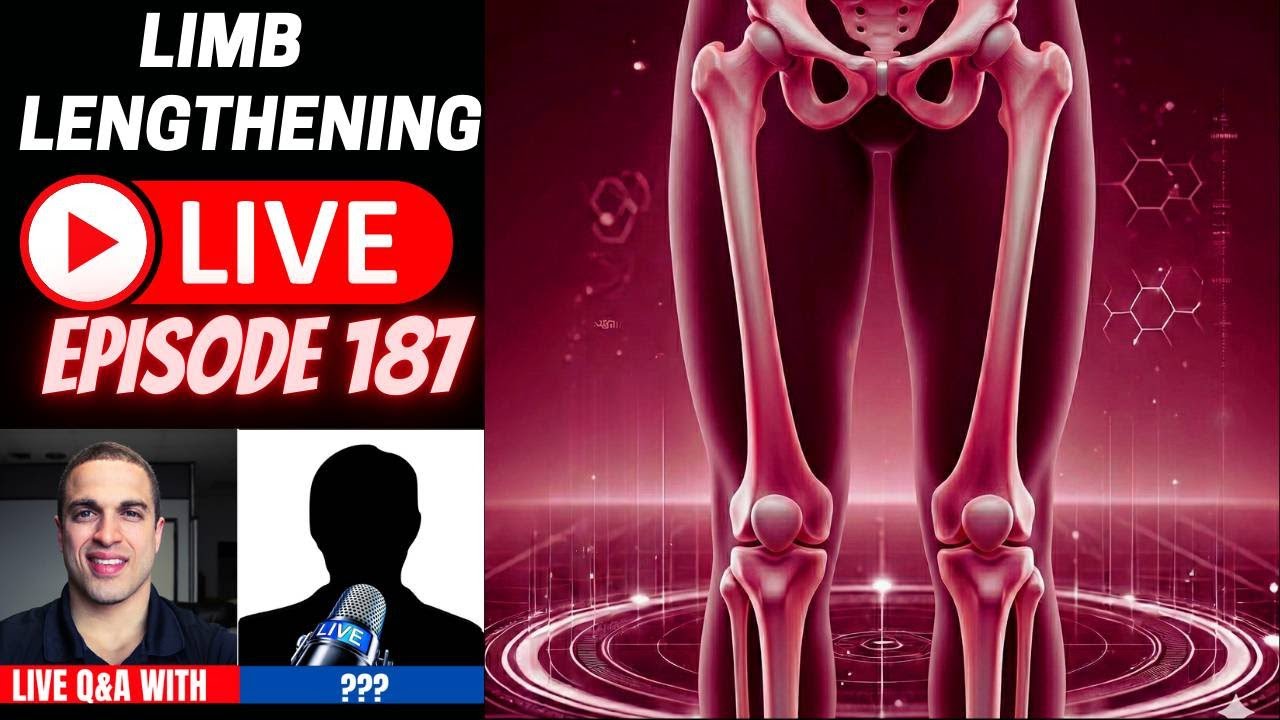 Limb Lengthening LIVE Ep. 187 – Patient Discussions w/ MD and Codeman Red