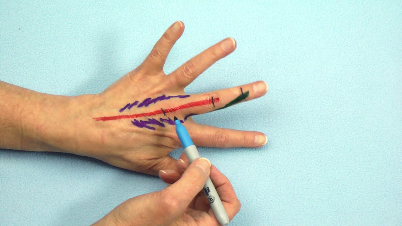Drawing the Dorsal Apparatus