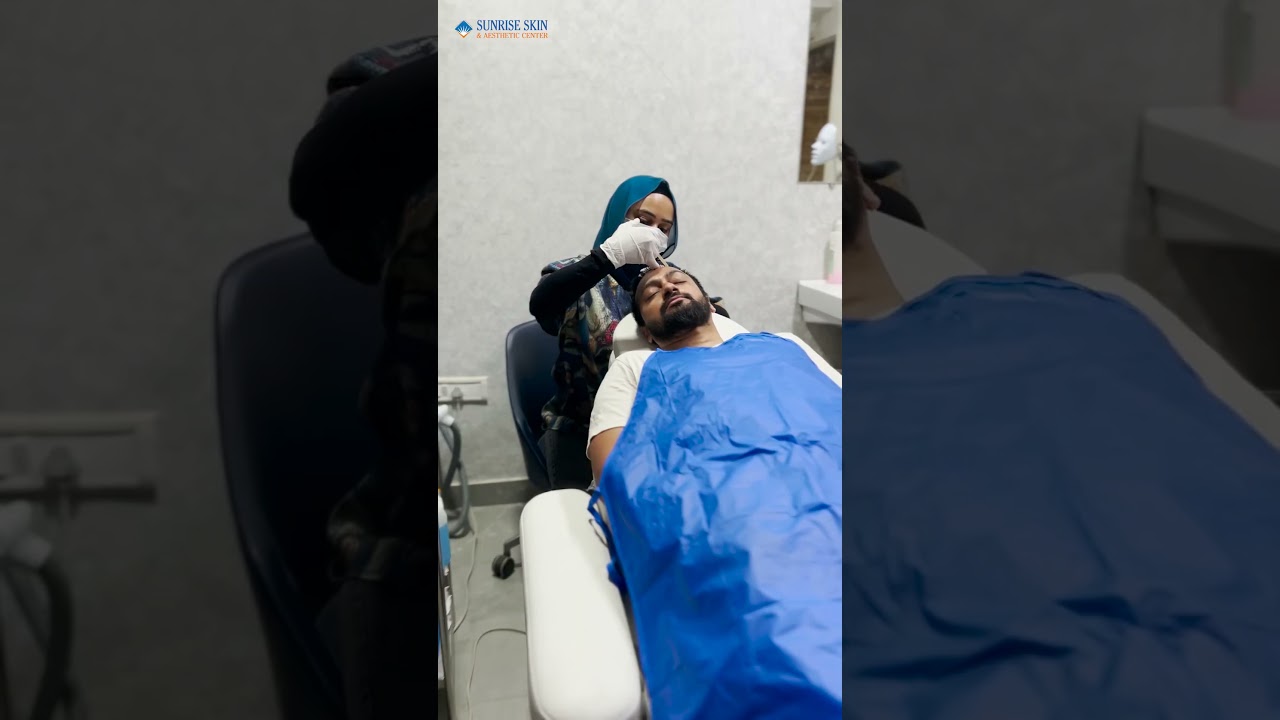 Hair PRP Transplant Procedure at Sunrise Skin & Aesthetic Center      #beauty #antiaging #clearskin
