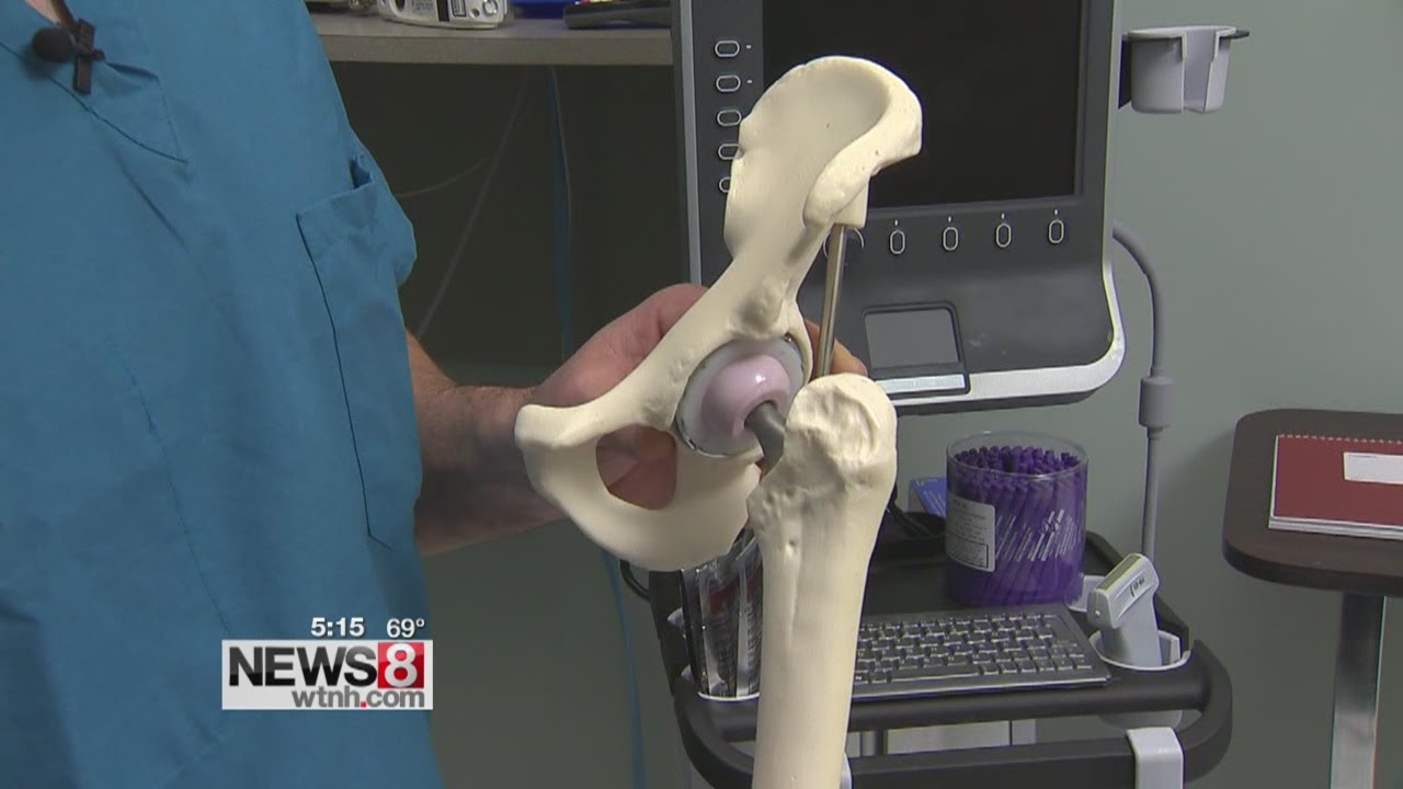 Less painful hip replacements done as outpatient surgery
