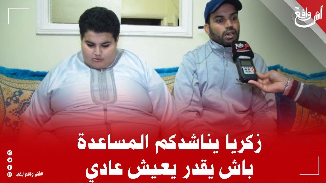 زكريا كايعااني من السمنة المفرطة بسبب خلل هرموني.. والاطباء داروه فأر تجارب