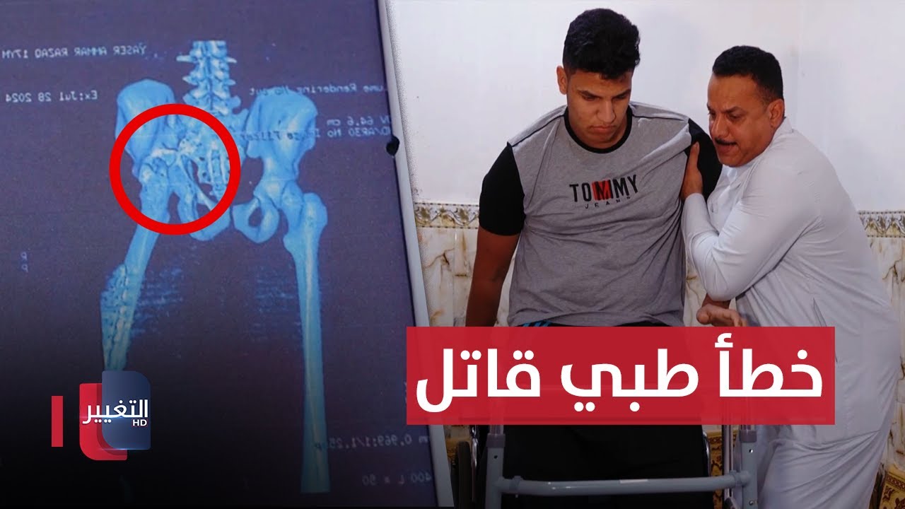 خطأ طبي 