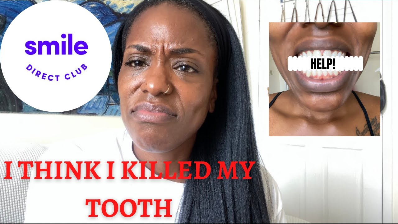 SMILE DIRECT CLUB IS KILLING MY TOOTH | WAS THIS A MISTAKE??!!
