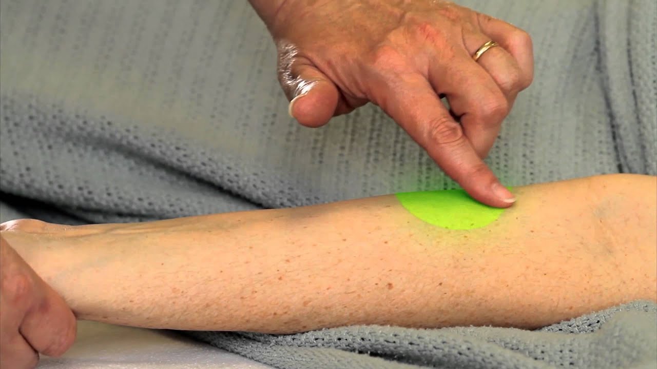 Intradermal Site Identification ~ivyVILOs~(Ivy Tech Community College, School of Nursing)