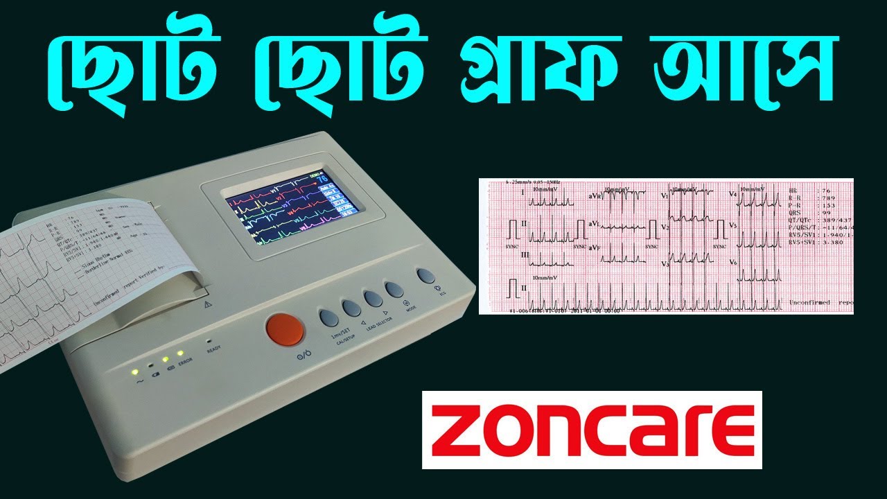 How to solve small ECG graph problem. Zoncare ZQ-1203G. Time Medical 360