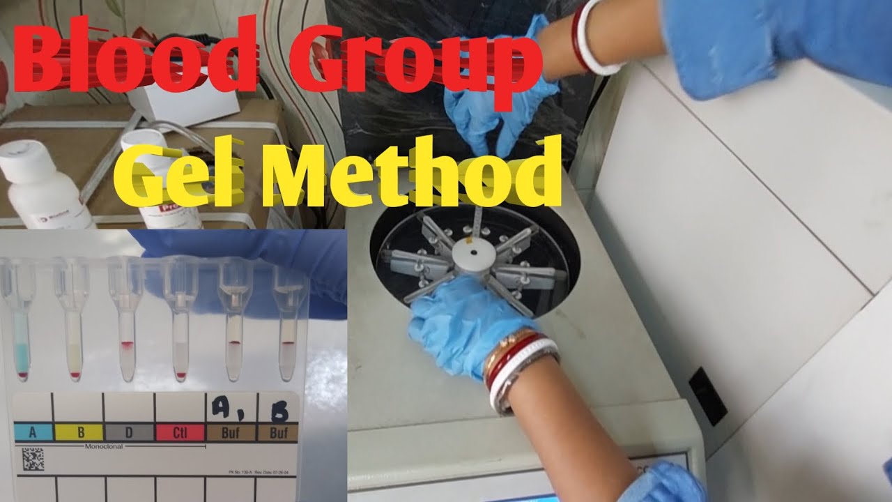 Blood Group Test By Gel Method || Forward Blood Grouping Gel Technology ||