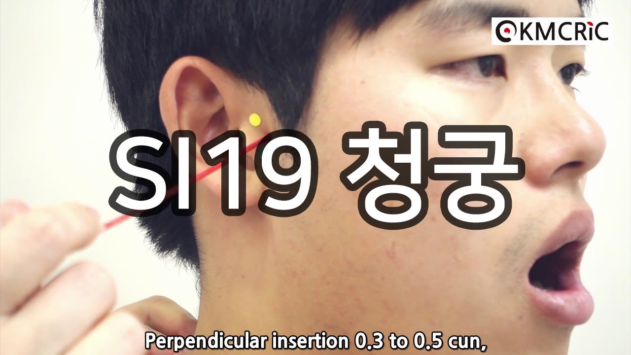 SI19 청궁 聽宮 Tinggong (Eng sub) - KMCRIC WHO Standard acupoint DB