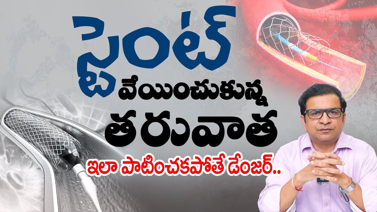 Dr. Movva Srinivas | Stent అంటే ఏమిటి? Heart కి వేసే Stent ఎలా పని చేస్తుంది? | Importance of Stents