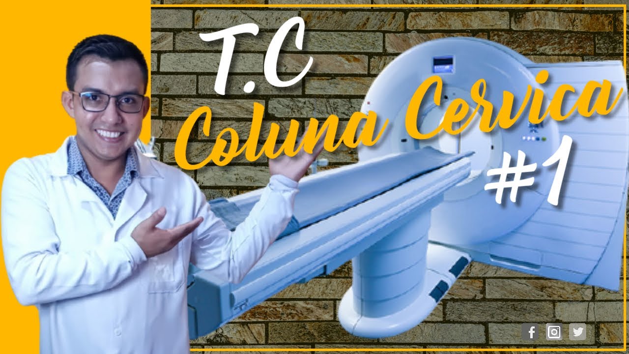TOMOGRAFIA DE COLUNA CERVICAL  #RADIOLOGIA