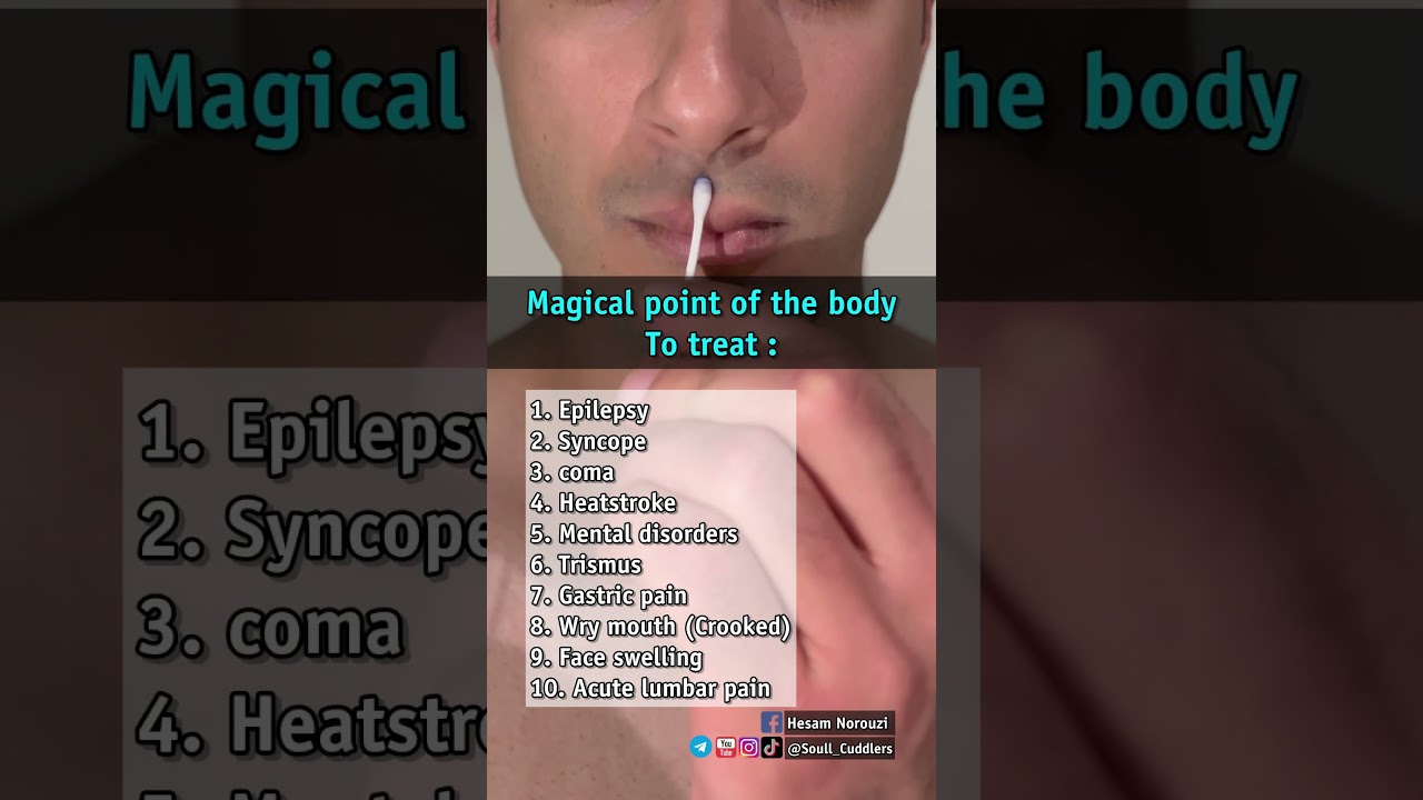 Acupressure special point .  #healing #acupressure #reflexology #acupuncture