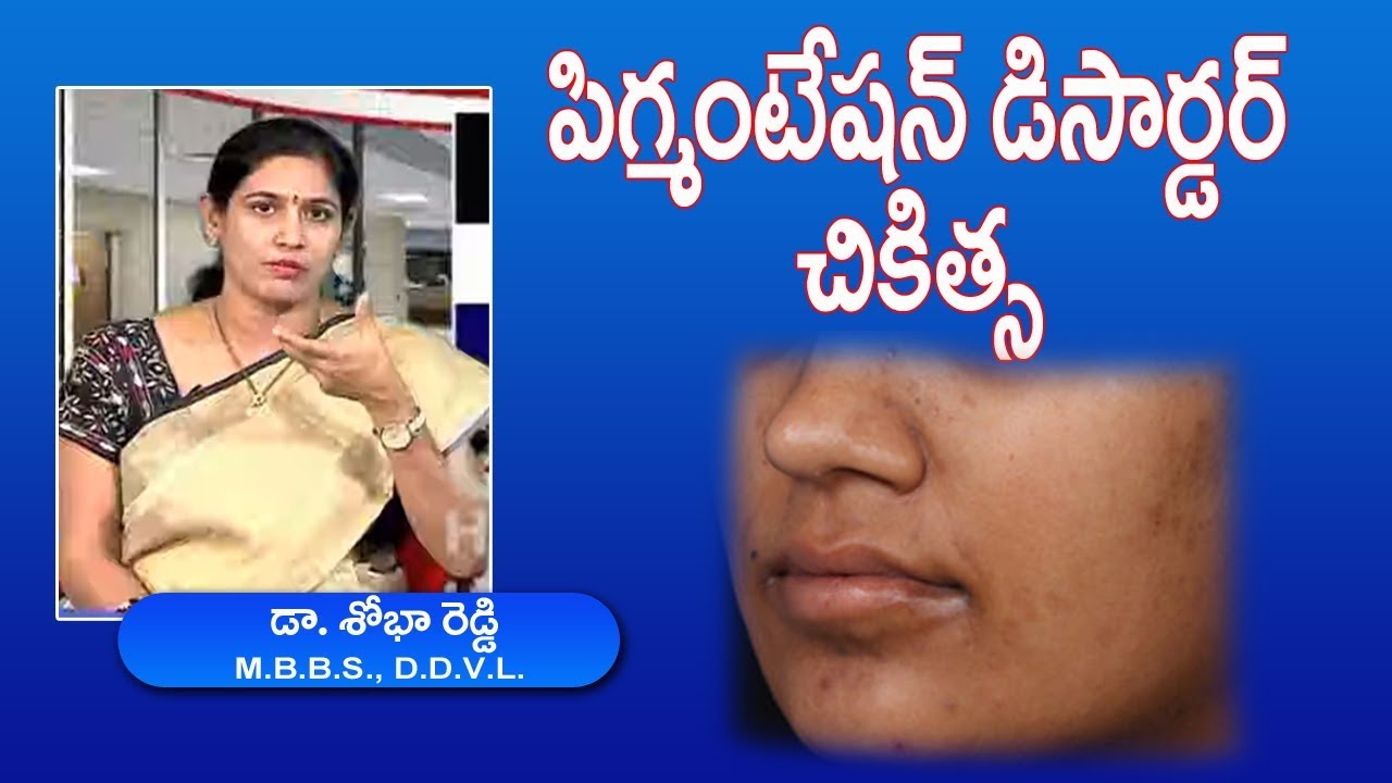 LIVE: What is Pigmentation By Dr. Shobha Reddy |Skin Pigmentation Disorders|Treatment,types & causes