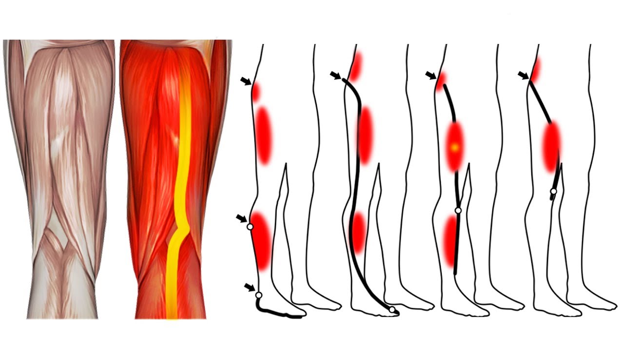 8 Semplici Esercizi per Ridurre Dolore alle Gambe e Ginocchia