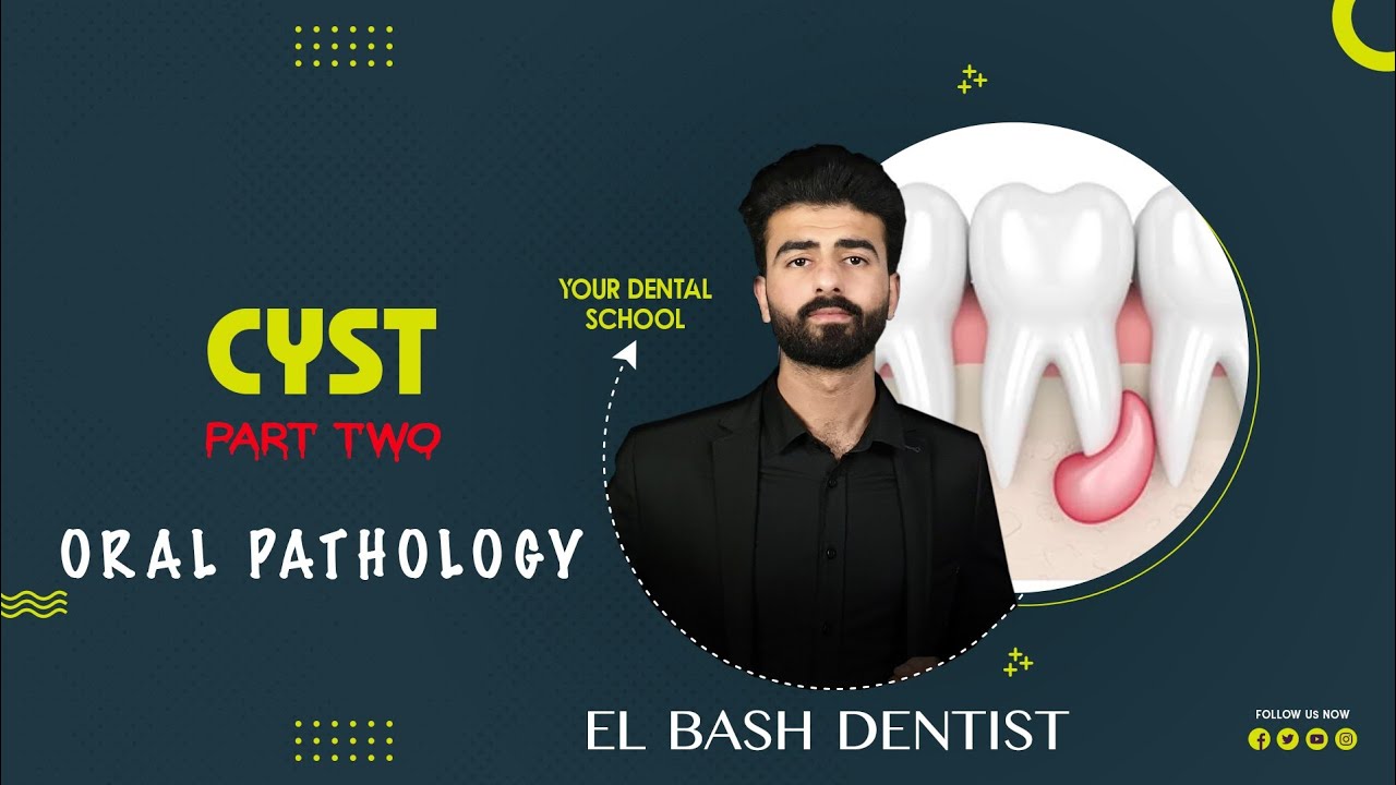 cysts || part 2 || oral pathology _ عزت شومان