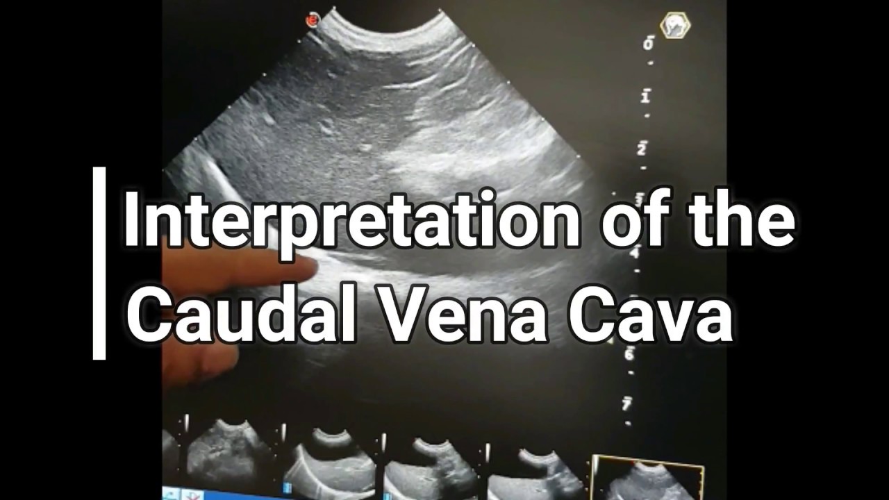 Vet Emergency Ultrasound: Interpretation of the Caudal Vena Cava